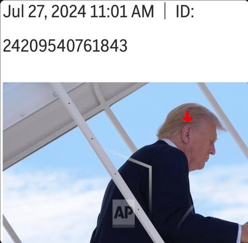 Trump's ear on July 27, pink and smooth as a baby's bottom. AP photo.